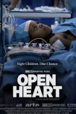 Watch Open Heart M4ufree