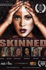 Watch Skinned M4ufree