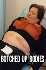 Watch Botched Up Bodies M4ufree