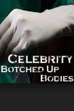 Watch Celebrity Botched Up Bodies M4ufree